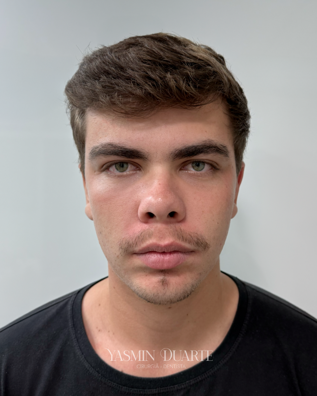 Depois